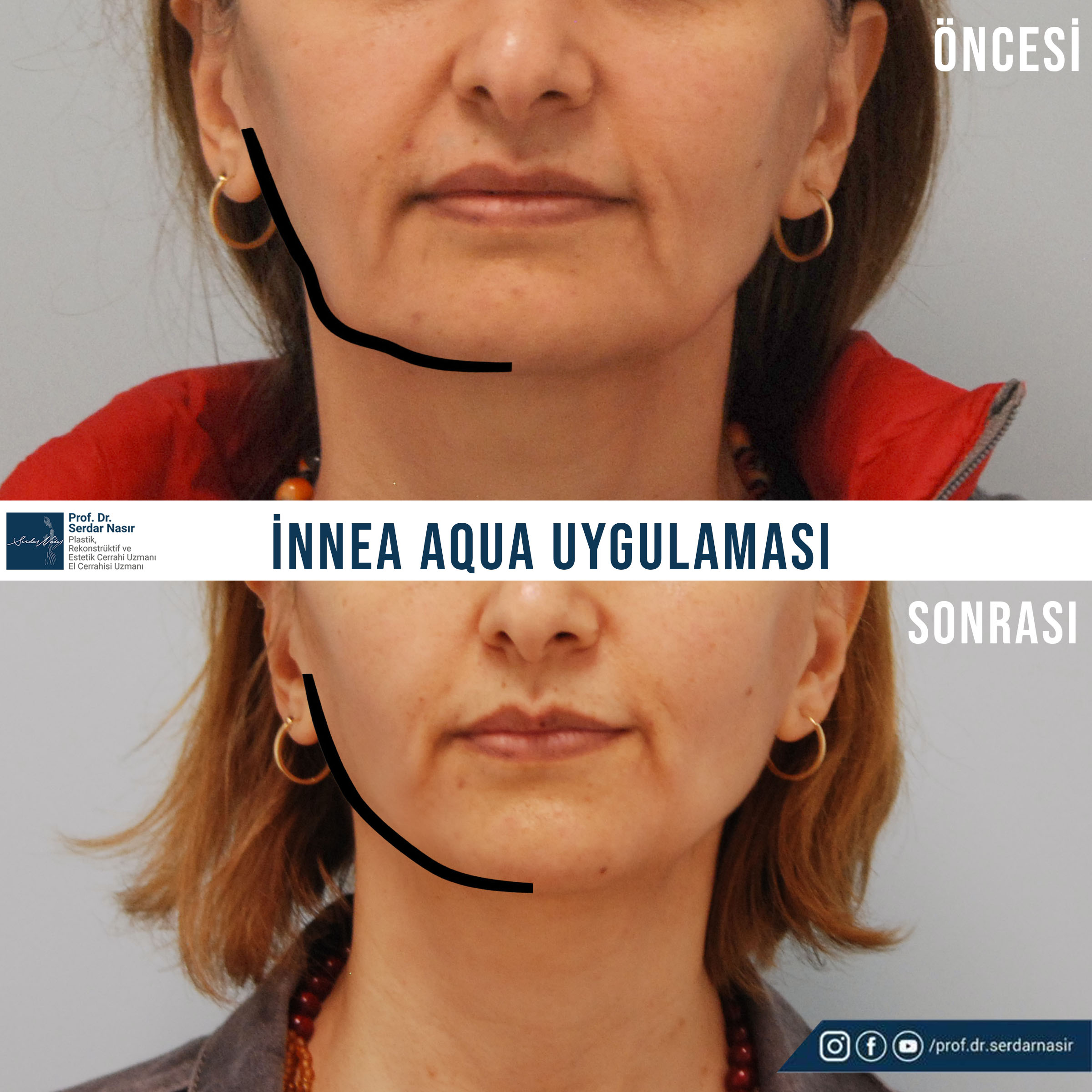 hatice ünal2