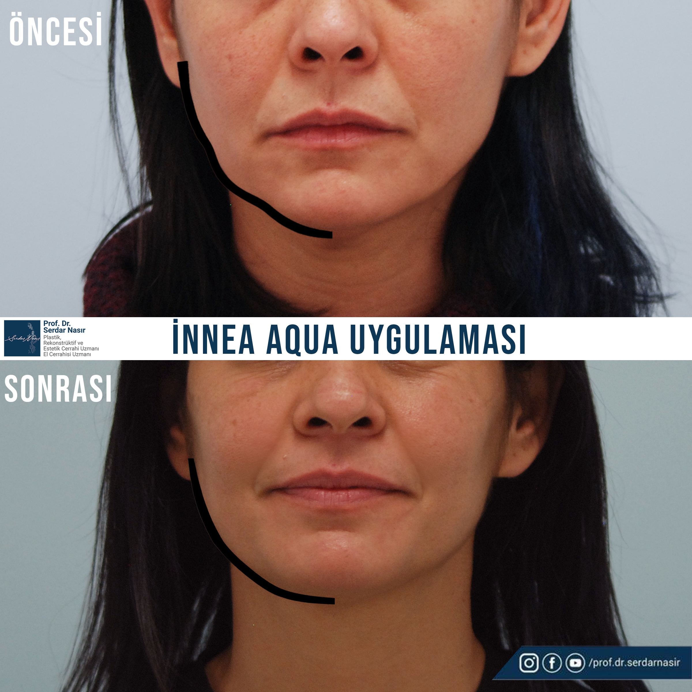 yekta
